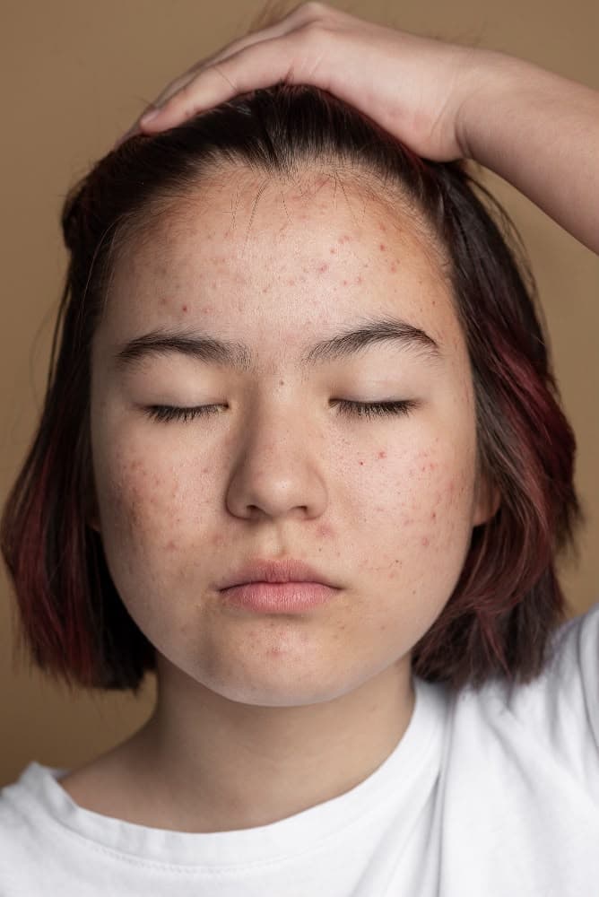 Skin state without routine