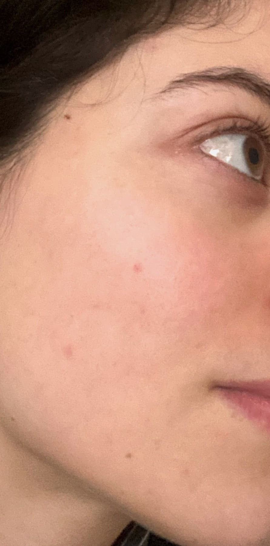 Clear, radiant, confident skin after CeraVe