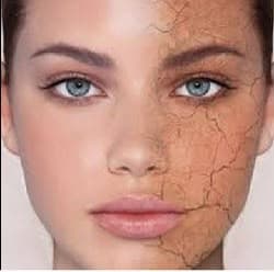Skin state without routine